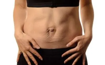 Diástasis abdominal. ¿Qué es?